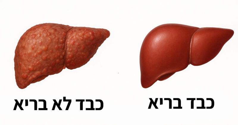 כבד לא בריא