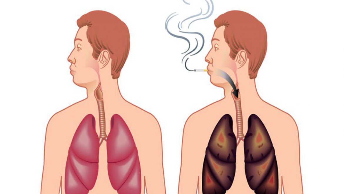 5 דרכים לניקוי והחייאת הריאות מעישון !