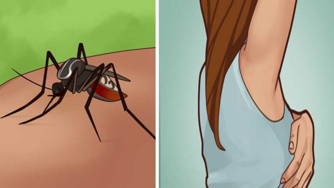 כל ניתן לטפל בקלות בעקיצות יתושים !