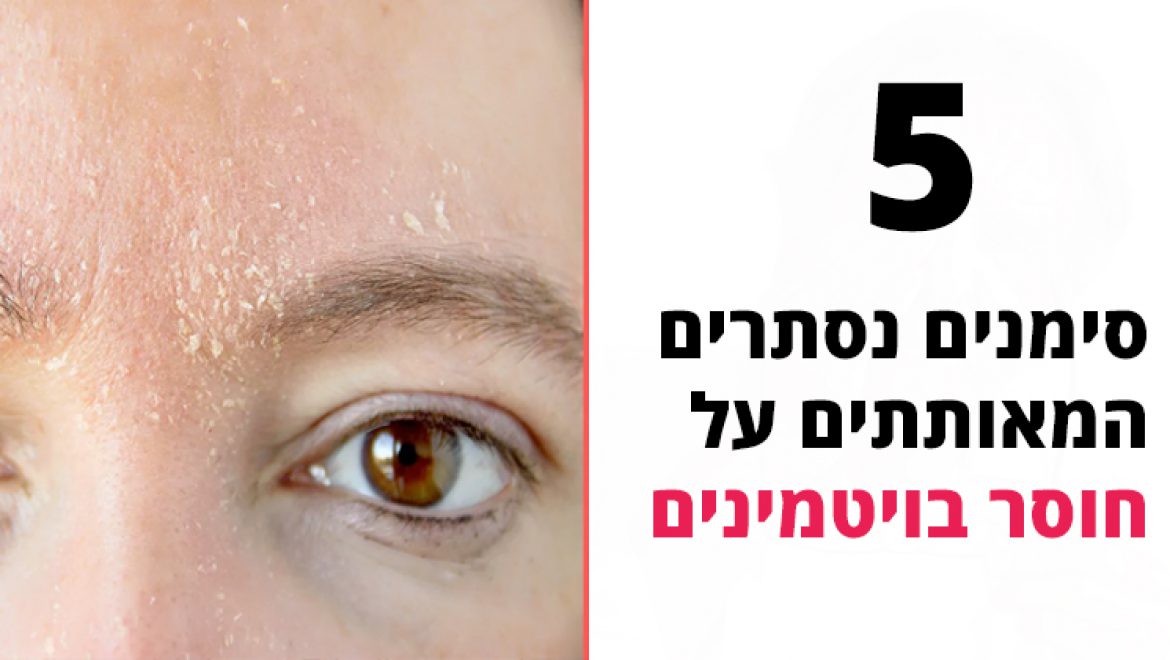 5 סימנים נסתרים המאותתים על חוסר בויטמינים