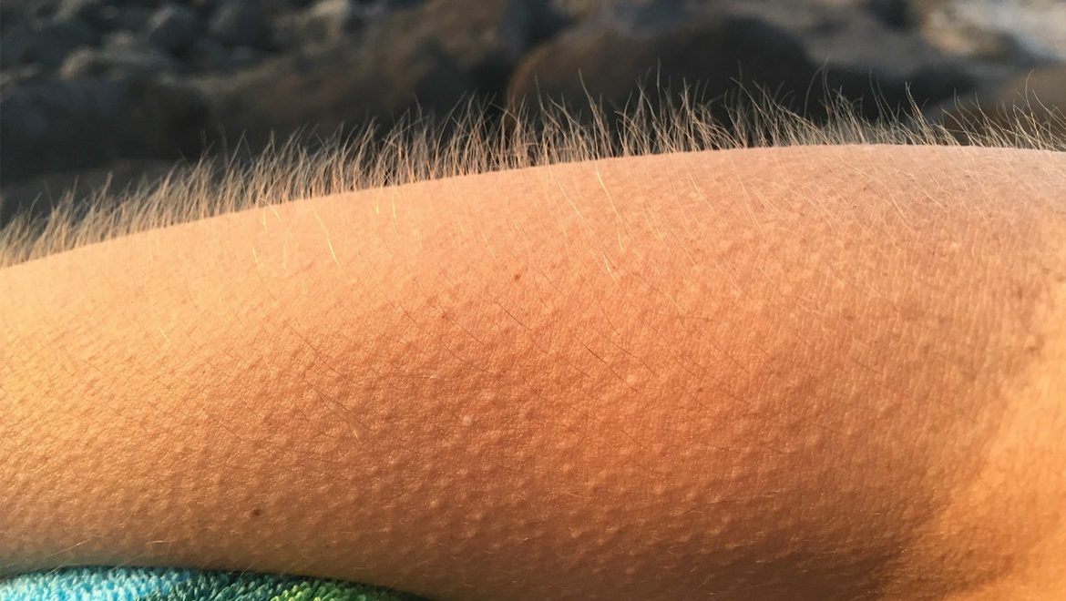אם יש לכם עור ברווז, הגוף מנסה לשדר לכם מסר !