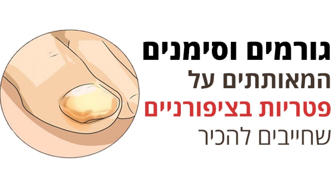 גורמים וסימנים המאותתים על פטריות בציפורניים שחייבים להכיר