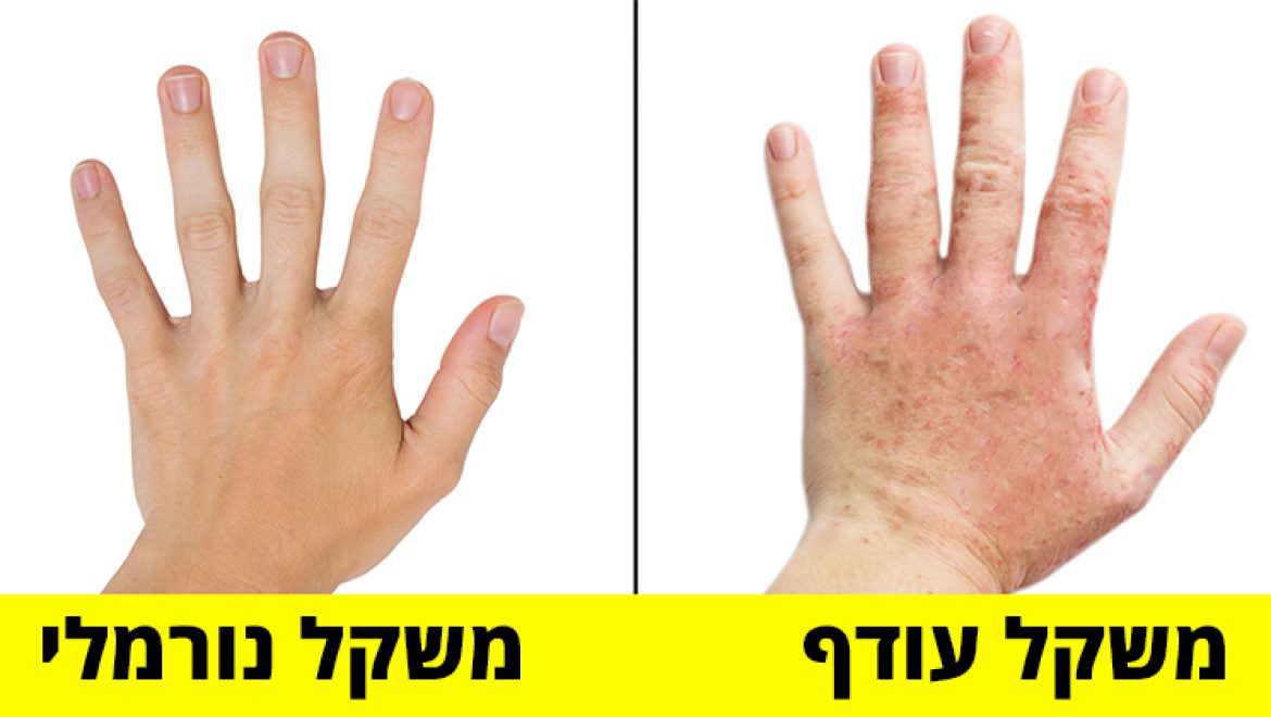 המדע מסביר איזה שינויים מתרחשים בגוף שלכם כשאתם יורדים במשקל