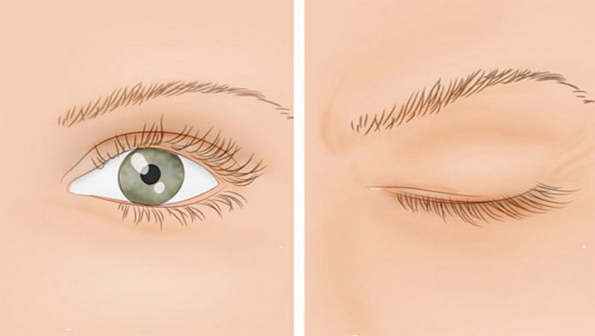 9 דרכים קלות כדי להגן על העיניים מפני נזק יומיומי