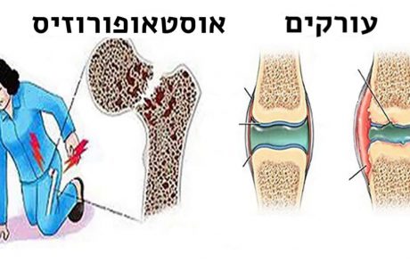 לעולם אל תוציאו אגורה עבור המשקאות האלה! זה מה שהם עושים לעצמות שלכם