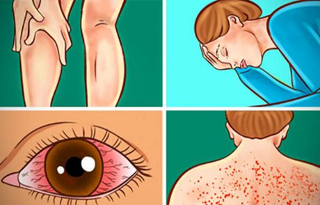 8 סימנים של מחלות עובש וכיצד ניתן לדעת אם אתם בסיכון