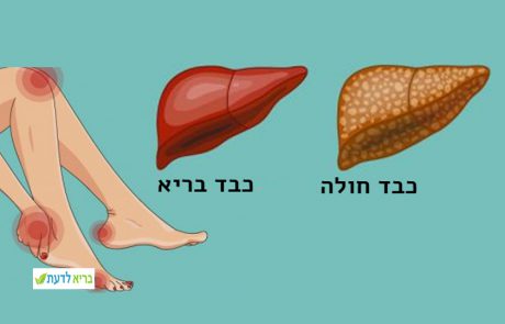 14 סימנים אשר מזהירים מעומס רעלים על הכבד שגורם להשמנה!