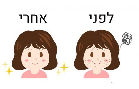 אלה המזונות שפוגעים בעור שלנו; ואלה המזונות המשקמים אותו