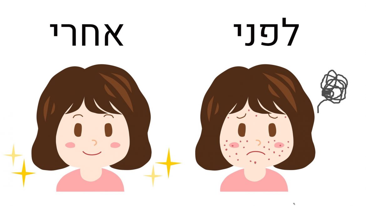 אלה המזונות שפוגעים בעור שלנו; ואלה המזונות המשקמים אותו