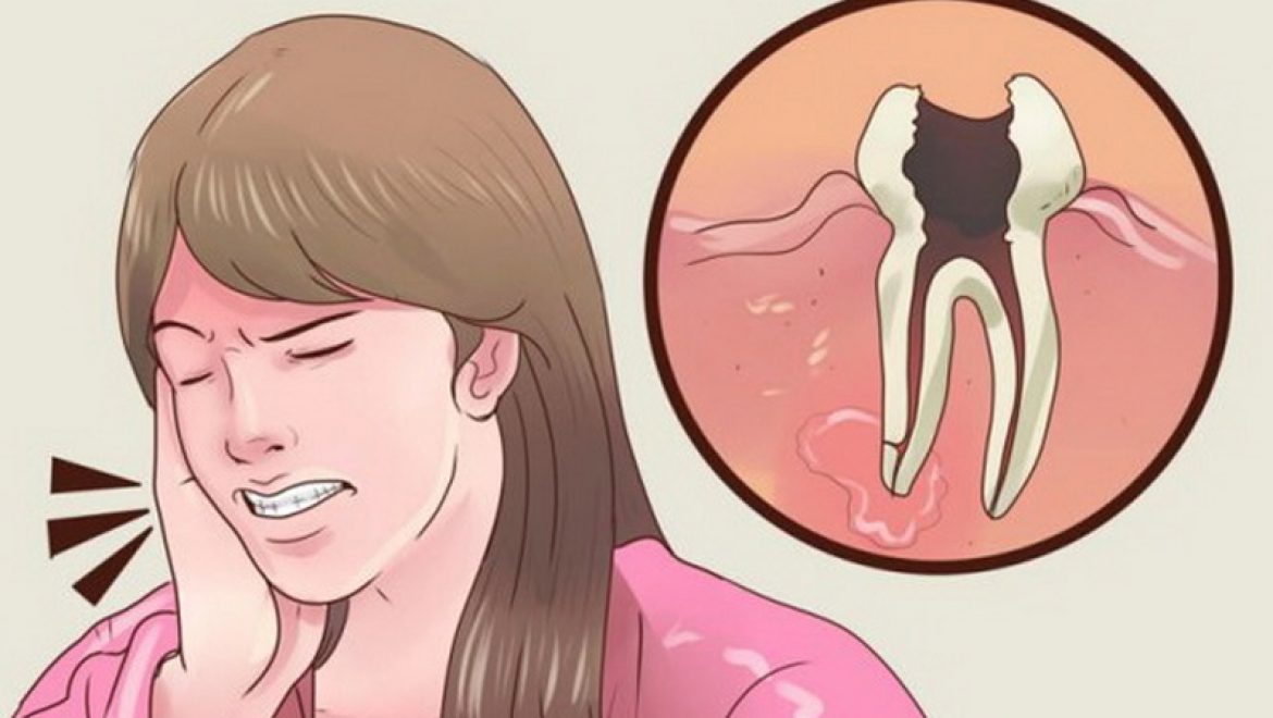 כיצד להפסיק כאב שיניים בלי ללכת לרופא השיניים?