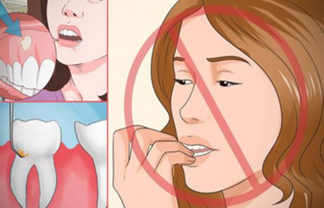 9 דרכים בהן אתם פוגעים בשיניים שלכם ולא יודעים על זה !!
